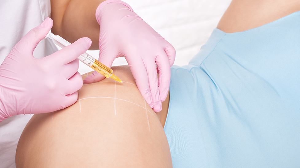 A woman receiving a PRP treatment in her hip area at Health For Life Naturopathic Medicine in Phoenix, AZ